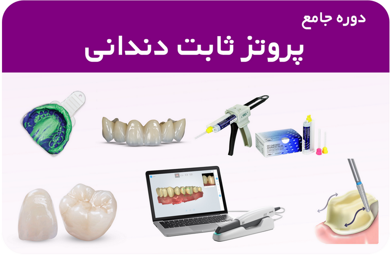 دوره جامع پروتز ثابت دندانی