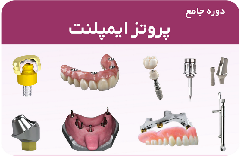 دوره جامع پروتز ایمپلنت